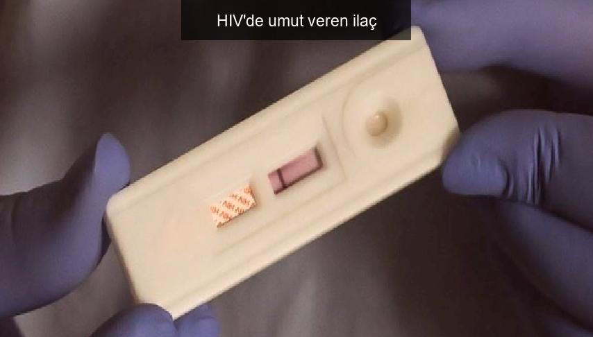 HIV’de umut veren ilaç